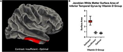 Clinical vitamin D levels are associated with insular volume and inferior temporal gyrus white matter surface area in community-dwelling individuals with knee pain